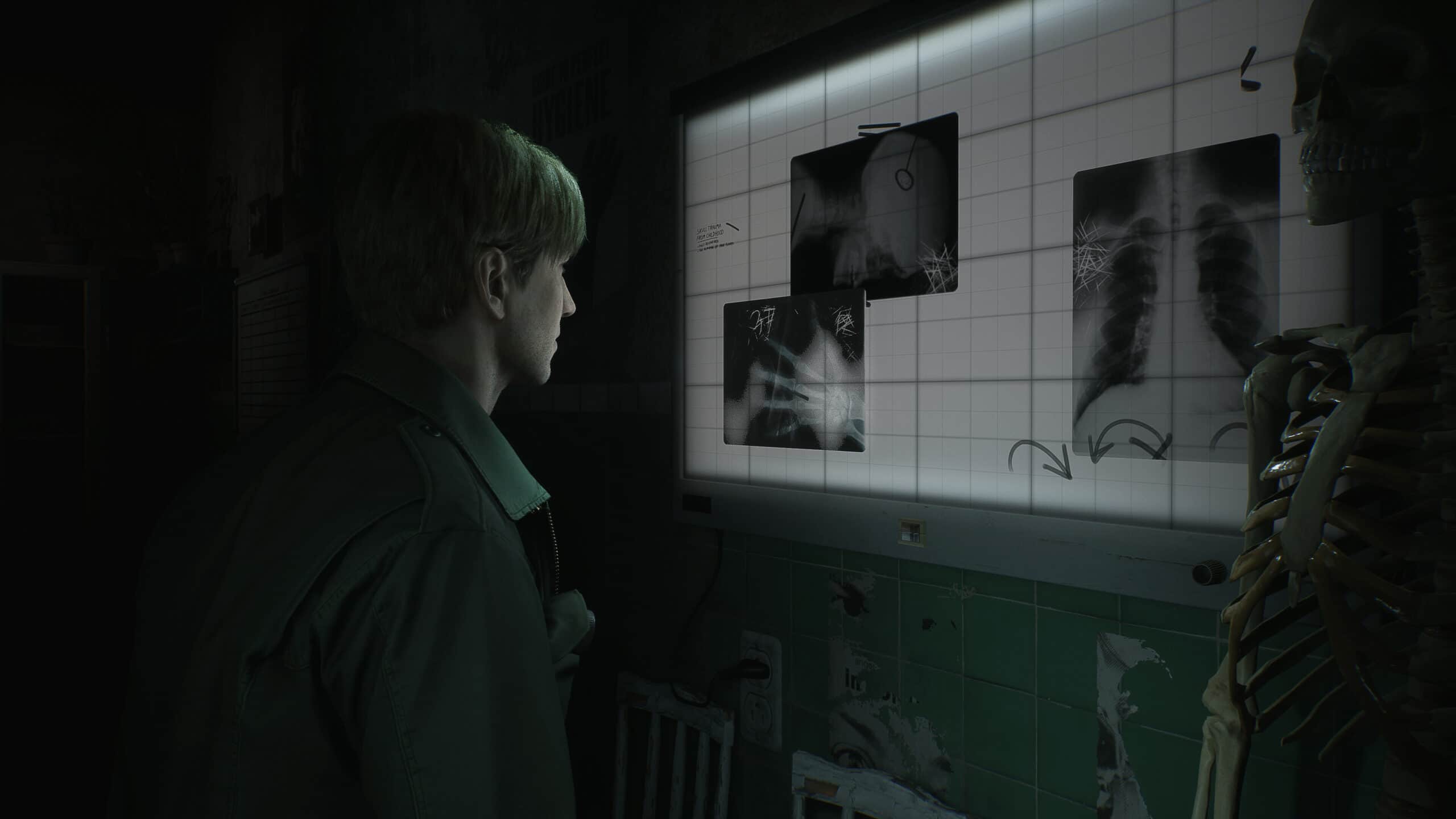 images 5 jpg Silent Hill 2 Remake: Release Date Revealed Alongside Tense Gameplay Footage