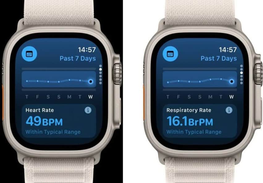 image 21 387 Exciting New Features in watchOS 11 You Might Have Overlooked