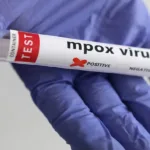 India Mpox: The Center issues a warning after getting the report of the first case of clade 1b infection