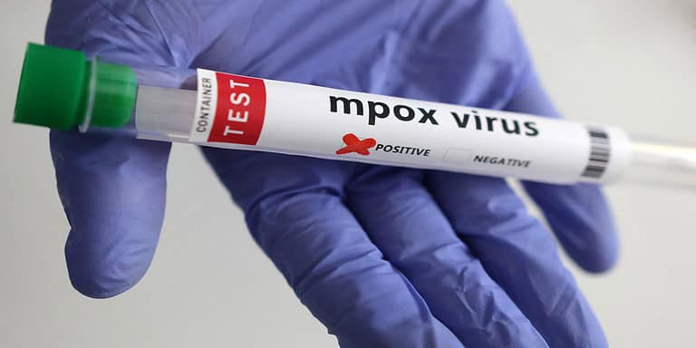 India Mpox: The Center issues a warning after getting the report of the first case of clade 1b infection
