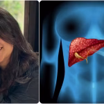 Dipika Kakar: Health Update, Liver Tumor Diagnosis, and What’s Next