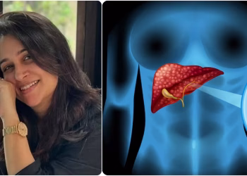 Dipika kakar liver tumor