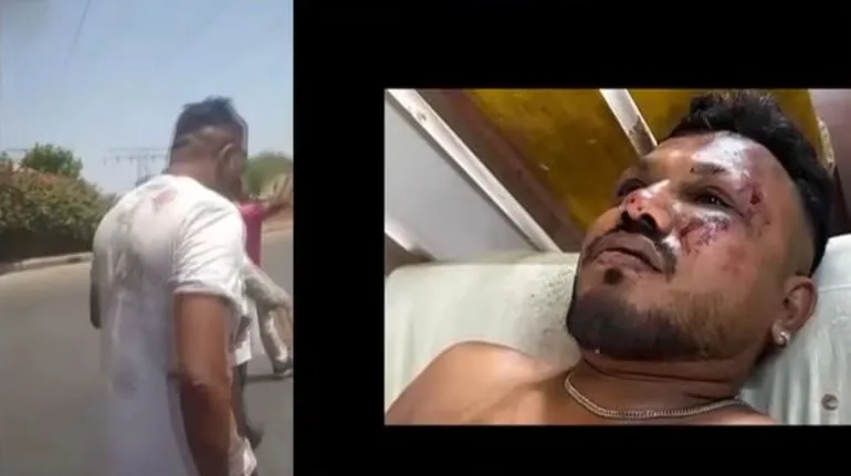 Air India Crash Survivor: Miracle Escape from Flight AI171 1 Air india crash survivor 1