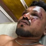 Air India Plane Crash Ahmedabad: One Survivor Found in Seat 11A – What’s the Condition of the Survivor?