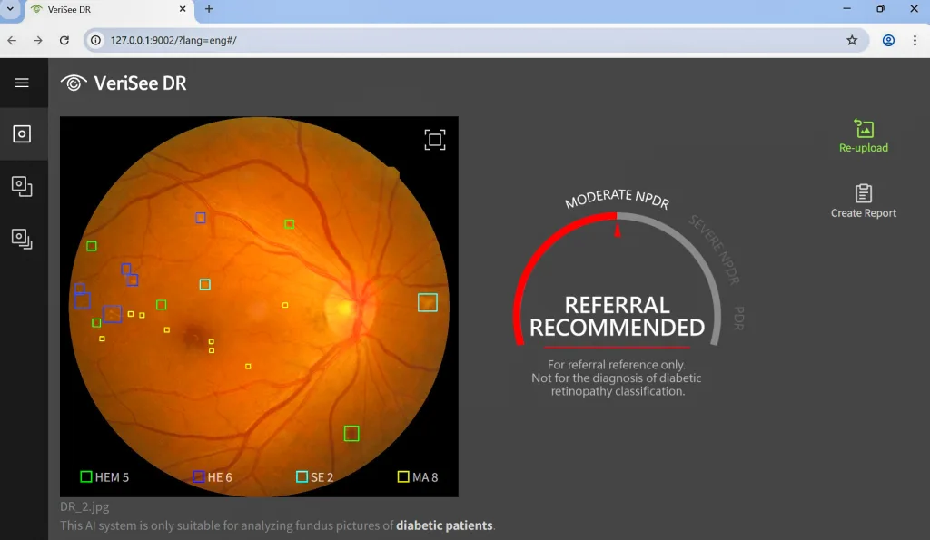 Acer medical aimed 2