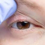 New AI Chip Optimized for Rapid Meibomian Gland Dysfunction Detection