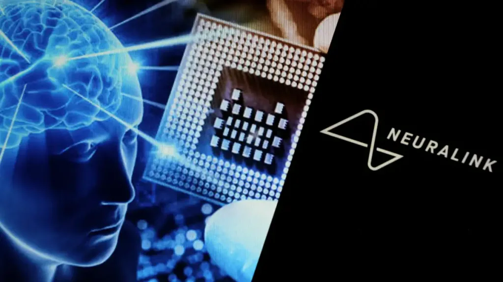 Neuralink